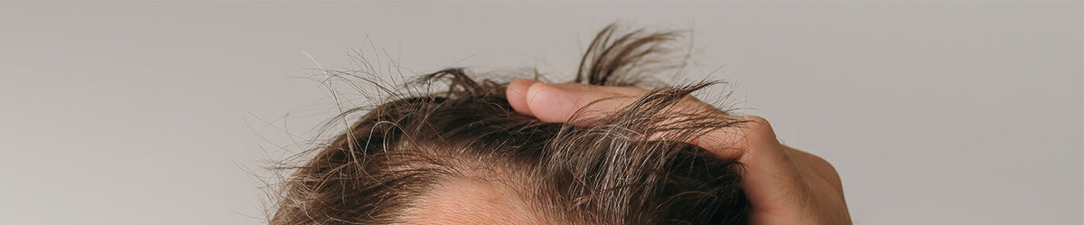Seborrhoische Dermatitis: Tipps zur natürlichen Behandlung